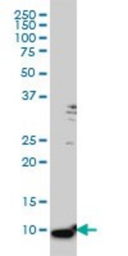 Monoclonal Anti-S100A6, (C-terminal) antibody produced