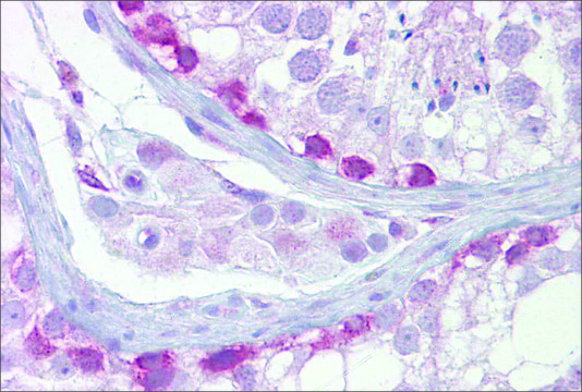 Anti-SYCP1 antibody produced in rabbit