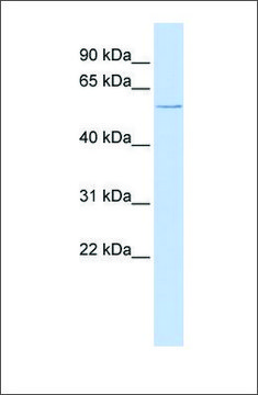 Anti-CFLAR antibody produced in rabbit