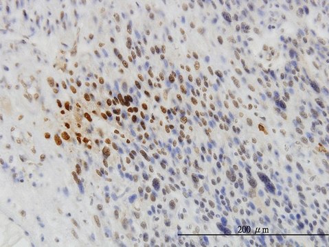 ANTI-TYK2 antibody produced in mouse