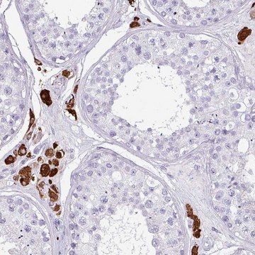 Anti-SLC35G2 antibody produced in rabbit