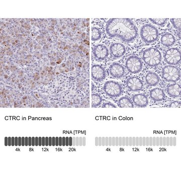 Anti-CTRC antibody produced in rabbit