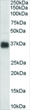 Anti-Clusterin/APOJ (AB1) antibody produced in
