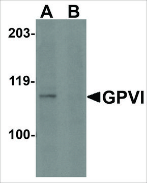 Anti-GPVI (ab2) antibody produced in