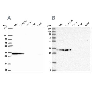 Anti-RPS3A antibody produced in rabbit