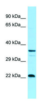 Anti-CD83 (C-terminal) antibody produced in