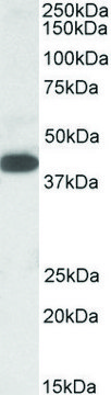 Anti-A4GNT (C-terminal) antibody produced in
