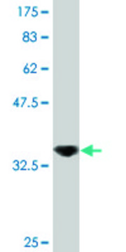 Monoclonal Anti-DDX56, (C-terminal) antibody produced