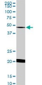 Monoclonal Anti-NADK antibody produced in