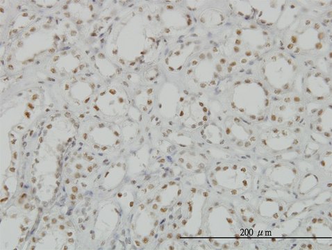 Monoclonal Anti-CDKL1 antibody produced in