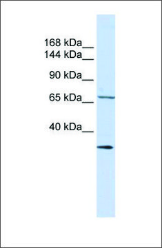 Anti-SEMA6D antibody produced in rabbit