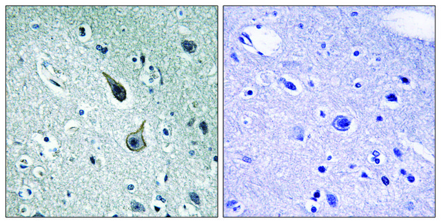 Anti-5-HT-2A antibody produced in rabbit