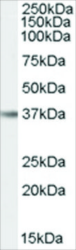 Anti-IL12B/IL12P40 (AB1) antibody produced in