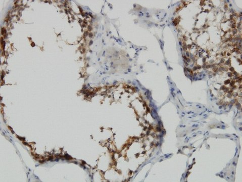 Monoclonal Anti-POMZP3 antibody produced in