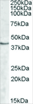 Anti-SPHK1 antibody produced in goat