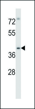 ANTI-MOUSE IRAK4 (C-TERM) antibody produced