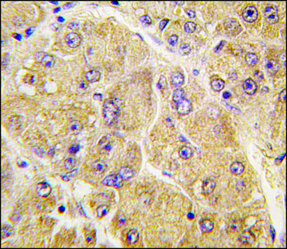 Anti-SOST (center) antibody produced in