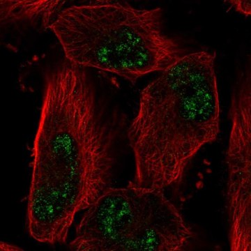Anti-ADAMTS4 antibody produced in rabbit