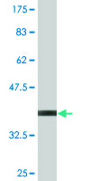 Monoclonal Anti-UBE2B antibody produced in