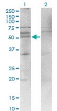 Monoclonal Anti-CXCR4, (N-terminal) antibody produced