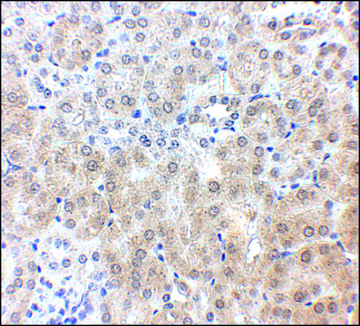 Anti-NPC1 antibody produced in rabbit