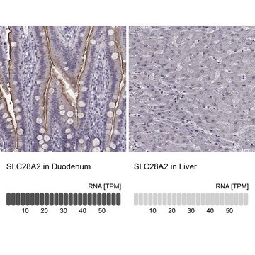 Anti-SLC28A2 antibody produced in rabbit