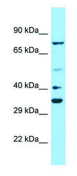 Anti-PAX2 antibody produced in rabbit