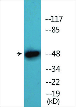 Anti-phospho-AML1 (pSer?³?) antibody produced in