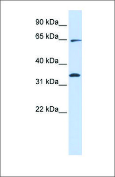 Anti-RHOT1 (ab1) antibody produced in