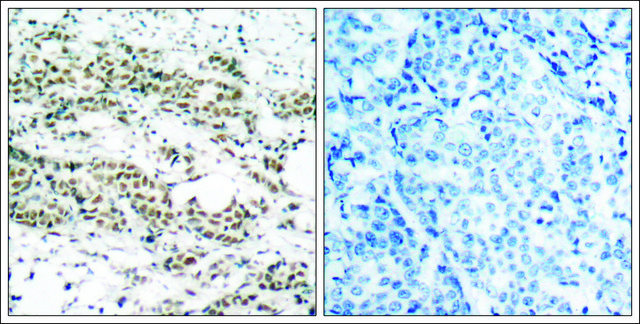 Anti-phospho-FOXO4 (pSer¹??) antibody produced in