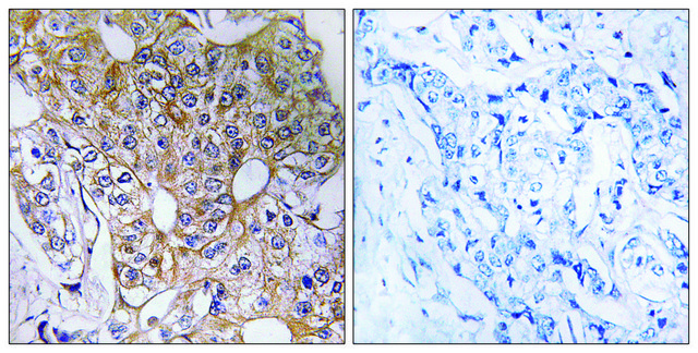 Anti-CCT6A antibody produced in rabbit