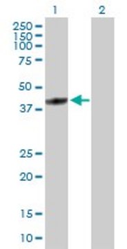 Anti-FBXL8 antibody produced in rabbit