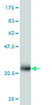 Monoclonal Anti-FBLIM1 antibody produced in