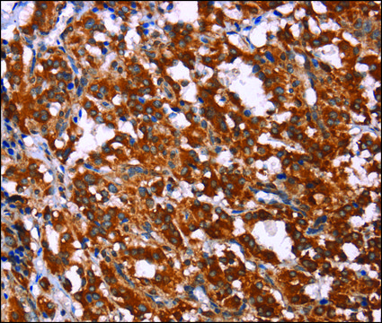Anti-GPR65 antibody produced in rabbit