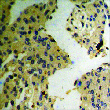 Anti-phospho-MARCKS (pSer¹?³) antibody produced in