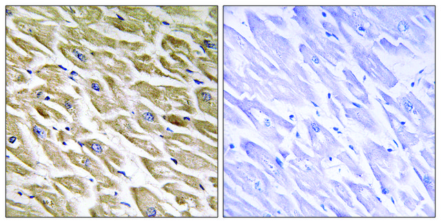 Anti-MRPL39 antibody produced in rabbit
