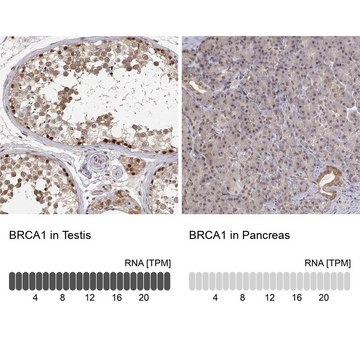 Anti-BRCA1