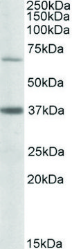 Anti-CPT2 antibody produced in goat