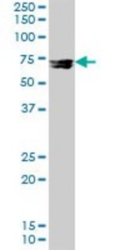 Anti-MMP12 antibody produced in rabbit