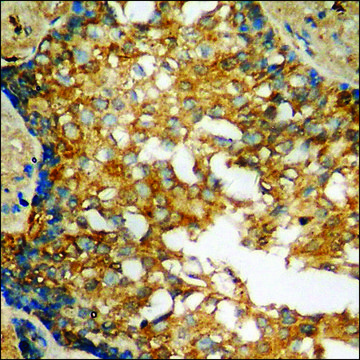 Anti-phospho-IRS-1 (pSer?³?) antibody produced in