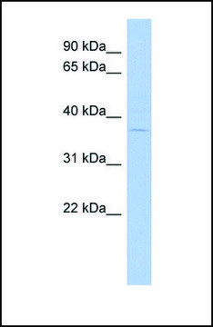 Anti-MARCH5, (N-terminal) antibody produced in