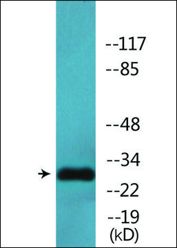 Anti-phospho-Proteasome ?3 (pSer²??) antibody produced