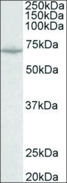 Anti-SLC6A8 antibody produced in goat