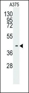 Anti-TBRG1 (center) antibody produced in