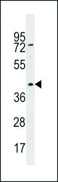 ANTI-RBMXL1 (CENTER) antibody produced in