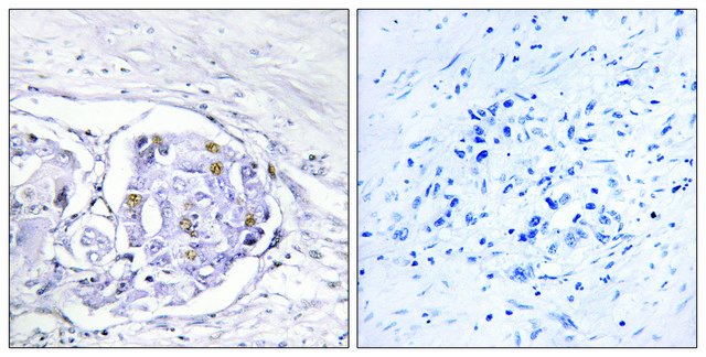 Anti-Progesterone Receptor antibody produced in