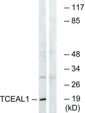Anti-TCEAL1 antibody produced in rabbit