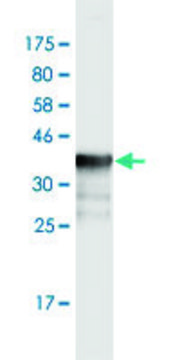 Monoclonal Anti-PPM1F, (N-terminal) antibody produced