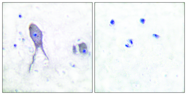 Anti-NOTCH2 (Cleaved-Asp¹?³³) antibody produced in