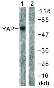 Anti-YAP antibody produced in rabbit
